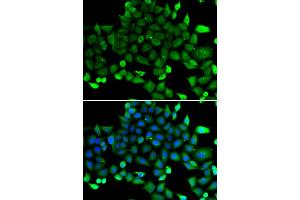 Immunofluorescence analysis of A549 cells using COMMD1 antibody (ABIN5974300). (COMMD1 抗体)