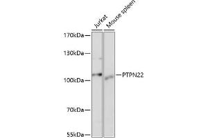 Western Blotting (WB) image for anti-Tyrosine-Protein Phosphatase Non-Receptor Type 22 (PTPN22) (AA 1-90) antibody (ABIN1513449)
