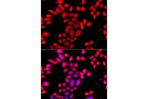 Immunofluorescence analysis of A549 cells using OSGEPL1 antibody. (OSGEPL1 抗体  (AA 1-270))