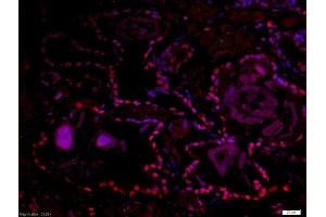Paraformaldehyde-fixed, paraffin embedded human prostate tissue, Antigen retrieval by boiling in sodium citrate buffer(pH6) for 15min, Block endogenous peroxidase by 3% hydrogen peroxide for 30 minutes, Blocking buffer (normal goat serum) at 37°C for 20min, Antibody incubation with Rabbit Anti-DMA/Dmrt1a Polyclonal Antibody, Unconjugated  at 1:500 overnight at 4°C, followed by a conjugated secondary and DAB staining (DMO/Dmrt1a (AA 51-100) 抗体)