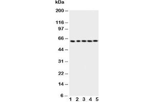 Western blot testing of p63 antbody; Lane 1: HeLa;  2: SMMC-7721;  3: COLO320;  4: A549;  5: SGC cell lysate (TCP1 alpha/CCTA 抗体  (AA 82-98))