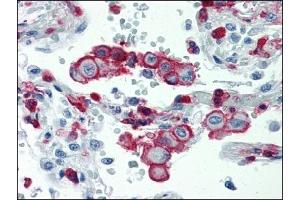 Immunohistochemistry (IHC) image for anti-Integrin beta 2 (ITGB2) antibody (ABIN614281) (Integrin beta 2 抗体)