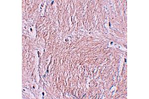 Western blot analysis of ZMYM3 in human brain tissue lysate with ZMYM3 antibody at 1 µg/mL. (ZMYM3 抗体  (C-Term))