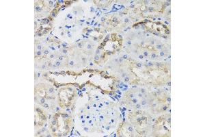 Immunohistochemistry of paraffin-embedded rat kidney using B9D1 antibody at dilution of 1:100 (x40 lens).