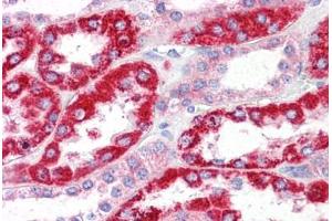Human Kidney: Formalin-Fixed, Paraffin-Embedded (FFPE) (OCIAD2 抗体  (N-Term))