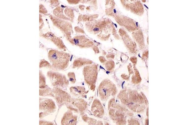 Very Low Density Lipoprotein (VLDL) (AA 484-510) 抗体