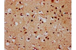 Immunohistochemistry (IHC) image for anti-Fibronectin Type III and SPRY Domain Containing 1 (FSD1) (AA 251-370) antibody (ABIN7152883)