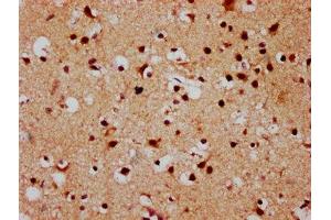 IHC image of ABIN7152883 diluted at 1:500 and staining in paraffin-embedded human brain tissue performed on a Leica BondTM system. (FSD1 抗体  (AA 251-370))