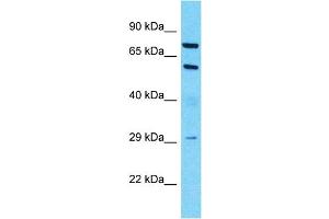 Host:  Rabbit  Target Name:  MUC13  Sample Type:  Lymph Node Tumor lysates  Antibody Dilution:  1. (MUC13 抗体  (C-Term))