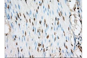 Immunohistochemical staining of paraffin-embedded liver tissue using anti-ACSBG1 mouse monoclonal antibody. (ACSBG1 抗体)