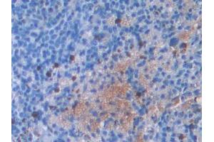 Used in DAB staining on fromalin fixed paraffin- embedded stomach tissue (IL2RG 抗体  (AA 23-263))