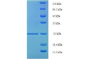 SDS-PAGE (SDS) image for Resistin (RETN) (AA 19-108) protein (His-SUMO Tag) (ABIN5710248)