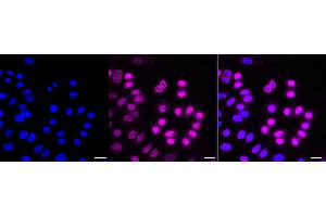 Immunocytochemical staining of HepG2 cells with Cyclin dependent kinase 1 antibody (ABIN7798206), 1:1,000). (Recombinant CDK1 抗体)