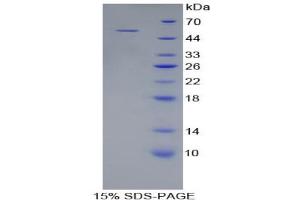 SDS-PAGE analysis of Rat Collagen Type XVIII Protein. (COL18 蛋白)