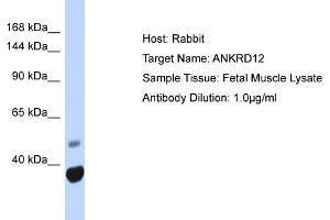 Host: Rabbit Target Name: ANKRD12 Sample Type: Fetal Muscle lysates Antibody Dilution: 1.