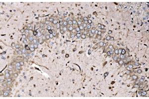 IHC analysis of FXR1 using anti-FXR1 antibody (ABIN7600093). (FXR1 抗体  (AA 149-614))