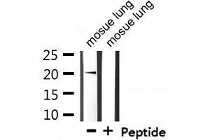 Western blot analysis of extracts from mosue lung, using Mammaglobin Antibody. (Mammaglobin A 抗体  (Internal Region))