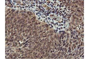 Image no. 1 for anti-V-Akt Murine Thymoma Viral Oncogene Homolog 1 (AKT1) antibody (ABIN1496555) (AKT1 抗体)