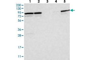 Western blot analysis of Lane 1: RT-4, Lane 2: U-251 MG, Lane 3: Human Plasma, Lane 4: Liver, Lane 5: Tonsil with PARP6 polyclonal antibody  at 1:250-1:500 dilution. (PARP6 抗体)