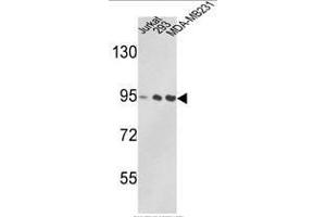 Western blot analysis of VCP Antibody (C-term) in Jurkat, 293, MDA-MB231 cell line lysates (35ug/lane). (VCP 抗体  (C-Term))