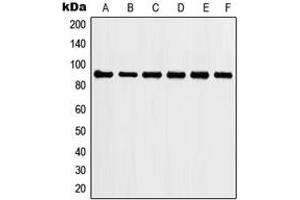 Western blot analysis of HSP90 alpha expression in MCF7 (A), HeLa (B), NIH3T3 (C), C6 (D), mouse liver (E), rat liver (F) whole cell lysates.