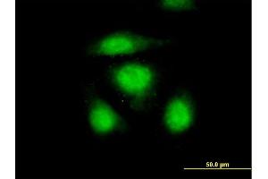 Immunofluorescence of purified MaxPab antibody to OSTF1 on HeLa cell. (OSTF1 抗体  (AA 1-217))