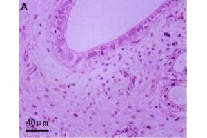 Haematoxylin and eosin and CD177 IHC staining in AS-affected and -unaffected oviduct tissues. (CD177 抗体  (AA 521-650))