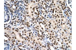 RSU1 antibody was used for immunohistochemistry at a concentration of 4-8 ug/ml to stain Epithelial cells of renal tubule (arrows) in Human Kidney. (RSU1 抗体  (C-Term))