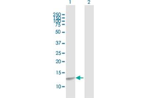 CREBL2 anticorps  (AA 1-120)