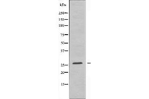 Western blot analysis of extracts from 293 cells using TSPAN8 antibody. (Tspan-8 抗体  (Internal Region))