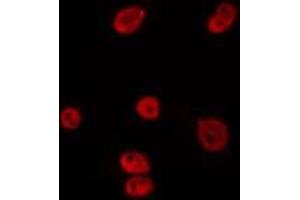 Immunofluorescence (fixed cells) (IF/ICC) image for anti-Replication Factor C (Activator 1) 2, 40kDa (RFC2) (Internal Region) antibody (ABIN6259175)