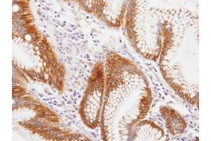 IHC-P Image Immunohistochemical analysis of paraffin-embedded human gastric , using MVP/LRP, antibody at 1:100 dilution. (MVP 抗体  (C-Term))