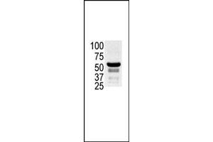 The anti-K2 b (ABIN392433 and ABIN2842033) is used in Western blot to detect K2 in ovary cell lysate. (PAK2 抗体  (N-Term))