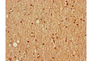 Immunohistochemistry (IHC) image for anti-Secretagogin, EF-Hand Calcium Binding Protein (SCGN) (AA 1-276) antibody (ABIN7168669)