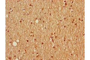 Immunohistochemistry of paraffin-embedded human brain tissue using ABIN7168669 at dilution of 1:100 (SCGN 抗体  (AA 1-276))