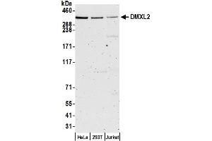 anti-Dmx-Like 2 (DMXL2) (AA 1450-1500) antibody