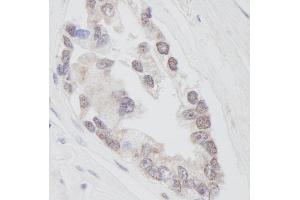 Immunohistochemistry (IHC) image for anti-Ring Finger Protein 40, E3 Ubiquitin Protein Ligase (RNF40) (AA 540-590) antibody (ABIN7448780)