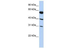 LYSMD4 antibody used at 1 ug/ml to detect target protein. (LYSMD4 抗体  (N-Term))