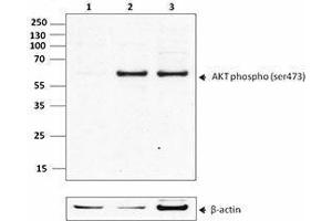 Western Blotting (WB) image for anti-V-Akt Murine Thymoma Viral Oncogene Homolog 1 (AKT1) (phosphorylated) antibody (ABIN2666091) (AKT1 抗体  (phosphorylated))