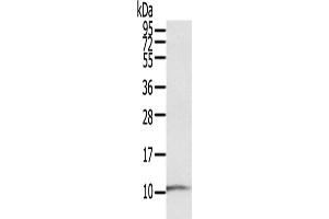 Western Blotting (WB) image for anti-S100 Calcium Binding Protein P (S100P) antibody (ABIN5544743) (S100P 抗体)