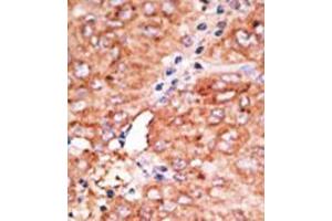 Image no. 2 for anti-Chemokine Binding Protein 2 (CCBP2) (C-Term) antibody (ABIN357386) (CCBP2 抗体  (C-Term))