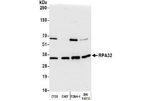 Western Blotting (WB) image for anti-Replication Protein A2, 32kDa (RPA2) (C-Term) antibody (ABIN7454599)