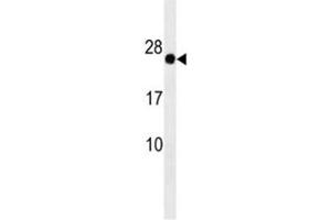 GAGE12F antibody western blot analysis in HepG2 lysate (G Antigen 12F 抗体  (AA 1-30))