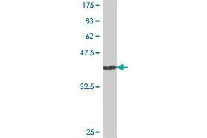 Western Blotting (WB) image for anti-Alcohol Dehydrogenase 7 (Class IV), mu Or sigma Polypeptide (ADH7) (AA 257-366) antibody (ABIN559795)