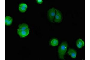 Immunofluorescent analysis of MCF-7 cells using ABIN7145218 at dilution of 1:100 and Alexa Fluor 488-congugated AffiniPure Goat Anti-Rabbit IgG(H+L) (BAG4 抗体  (AA 6-185))