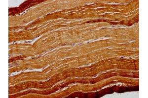 Immunohistochemistry (IHC) image for anti-ATPase, Ca++ Transporting, Cardiac Muscle, Fast Twitch 1 (ATP2A1) (AA 384-579) antibody (ABIN7168596)