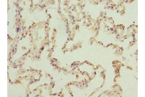 Immunohistochemistry of paraffin-embedded human lung tissue using ABIN7151524 at dilution of 1:100 (ELMOD1 抗体  (AA 185-334))