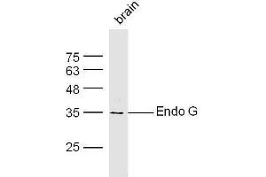 Endonuclease G 抗体  (AA 101-200)