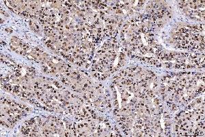 IHC analysis of FEN1 using anti-FEN1 antibody (ABIN7601618).