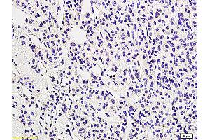 Formalin-fixed and paraffin embedded human adrenal tissue labeled with Anti LHR/CGR Polyclonal Antibody, Unconjugated (ABIN873328) followed by conjugation to the secondary antibody and DAB staining (LHCGR 抗体  (AA 201-300))